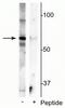 Methyl-CpG Binding Protein 2 antibody, P00047, Boster Biological Technology, Western Blot image 