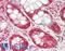 USP6 N-Terminal Like antibody, LS-B14082, Lifespan Biosciences, Immunohistochemistry paraffin image 
