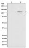 Sirtuin 1 antibody, P00018-1, Boster Biological Technology, Western Blot image 