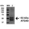 Cysteine protease ATG4D antibody, SPC-635D-A565, StressMarq, Western Blot image 