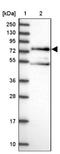 Amyloid Beta Precursor Protein Binding Family A Member 3 antibody, NBP1-92117, Novus Biologicals, Western Blot image 