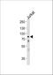 Heat Shock Protein Family A (Hsp70) Member 6 antibody, A05402-2, Boster Biological Technology, Western Blot image 