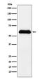 Serpin Family A Member 3 antibody, M02312, Boster Biological Technology, Western Blot image 