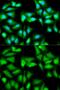 Glutathione Synthetase antibody, GTX55641, GeneTex, Immunocytochemistry image 