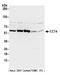 Chaperonin Containing TCP1 Subunit 4 antibody, A304-725A, Bethyl Labs, Western Blot image 