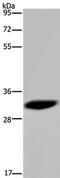 High Mobility Group Nucleosome Binding Domain 5 antibody, PA5-50468, Invitrogen Antibodies, Western Blot image 