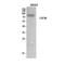 Colony Stimulating Factor 3 Receptor antibody, STJ96892, St John