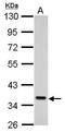 SEC61 Translocon Alpha 1 Subunit antibody, TA308684, Origene, Western Blot image 
