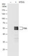 Thymine DNA Glycosylase antibody, GTX631718, GeneTex, Western Blot image 