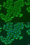 Exocyst Complex Component 2 antibody, 23-472, ProSci, Immunofluorescence image 