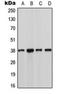 Casein Kinase 1 Alpha 1 antibody, orb216077, Biorbyt, Western Blot image 