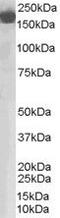 Complement Factor H antibody, PA5-18402, Invitrogen Antibodies, Western Blot image 