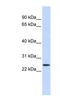 Proline Rich And Gla Domain 1 antibody, NBP1-59907, Novus Biologicals, Western Blot image 