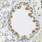 Cartilage Associated Protein antibody, 19-366, ProSci, Immunohistochemistry paraffin image 