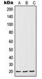 Interleukin 7 antibody, LS-C352363, Lifespan Biosciences, Western Blot image 