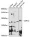 Cyclin Dependent Kinase 12 antibody, 15-778, ProSci, Western Blot image 