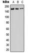 Adenylate Cyclase 9 antibody, GTX54909, GeneTex, Western Blot image 