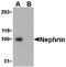 NPHS1 Adhesion Molecule, Nephrin antibody, PA5-20330, Invitrogen Antibodies, Western Blot image 