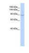 Zinc Finger CCCH-Type Containing 7A antibody, NBP1-79987, Novus Biologicals, Western Blot image 