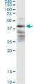 Zinc finger FYVE domain-containing protein 19 antibody, H00084936-M02, Novus Biologicals, Immunoprecipitation image 