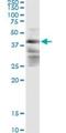Zinc Finger FYVE-Type Containing 19 antibody, H00084936-M02, Novus Biologicals, Immunoprecipitation image 