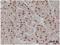 H1 Histone Family Member 0 antibody, NB100-65220, Novus Biologicals, Immunohistochemistry frozen image 