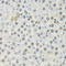 Cyclin Dependent Kinase 6 antibody, LS-C331529, Lifespan Biosciences, Immunohistochemistry frozen image 