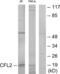 Cofilin 2 antibody, abx013962, Abbexa, Western Blot image 