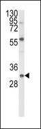 Glial Cell Derived Neurotrophic Factor antibody, LS-C166432, Lifespan Biosciences, Western Blot image 