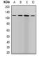 Procollagen-Lysine,2-Oxoglutarate 5-Dioxygenase 1 antibody, abx141443, Abbexa, Western Blot image 