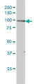 Protein Kinase D2 antibody, LS-B5453, Lifespan Biosciences, Western Blot image 