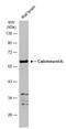 Protein Phosphatase 3 Catalytic Subunit Alpha antibody, GTX105003, GeneTex, Western Blot image 