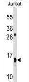 ATP Synthase F1 Subunit Delta antibody, LS-C156655, Lifespan Biosciences, Western Blot image 