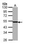 Proteasome 26S Subunit, ATPase 3 antibody, NBP1-32749, Novus Biologicals, Western Blot image 