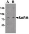 Sterile Alpha And TIR Motif Containing 1 antibody, PA5-34402, Invitrogen Antibodies, Western Blot image 