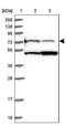 Chromosome 10 Open Reading Frame 90 antibody, PA5-58480, Invitrogen Antibodies, Western Blot image 