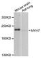 Myosin Heavy Chain 7 antibody, STJ29702, St John