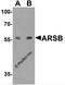 Arylsulfatase B antibody, 7465, ProSci, Western Blot image 