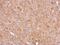 RIO Kinase 3 antibody, NBP2-20165, Novus Biologicals, Immunohistochemistry paraffin image 