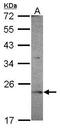 OVCA2 Serine Hydrolase Domain Containing antibody, GTX119385, GeneTex, Western Blot image 