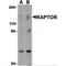 Regulatory Associated Protein Of MTOR Complex 1 antibody, MBS150268, MyBioSource, Western Blot image 