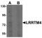 Leucine Rich Repeat Transmembrane Neuronal 4 antibody, TA320026, Origene, Western Blot image 