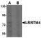 Leucine-rich repeat transmembrane neuronal protein 4 antibody, TA320026, Origene, Western Blot image 