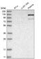 Adenosine Monophosphate Deaminase 2 antibody, NBP2-48578, Novus Biologicals, Western Blot image 