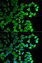 Diaphanous Related Formin 1 antibody, 19-849, ProSci, Immunofluorescence image 