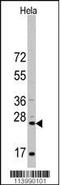 CD8 antibody, 57-511, ProSci, Western Blot image 