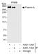 Filamin A antibody, A301-135A, Bethyl Labs, Immunoprecipitation image 