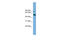 Iroquois Homeobox 5 antibody, ARP37245_P050, Aviva Systems Biology, Western Blot image 