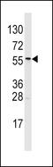 Aldehyde Dehydrogenase 6 Family Member A1 antibody, 57-922, ProSci, Western Blot image 