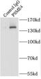 Proteasome Activator Subunit 4 antibody, FNab06897, FineTest, Immunoprecipitation image 